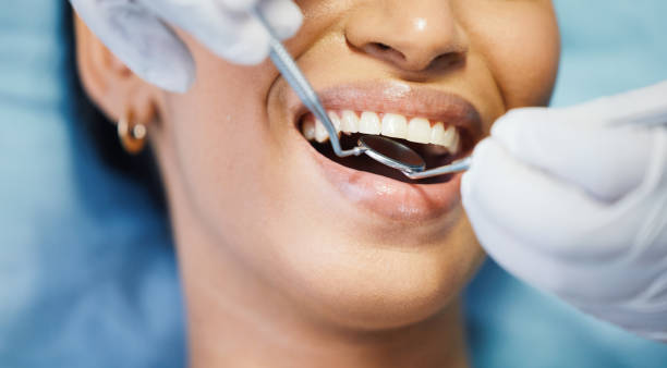 Best Emergency Dental Extractions in Westwood Shores, TX